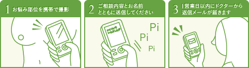 1.お悩み部位を携帯で撮影/2.ご相談内容とお名前とともに送信してください/3.数日後ドクターから返信メールが届きます