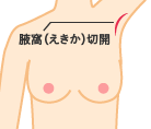 正面