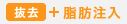 脂肪注入 