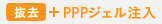 PPPジェル注入