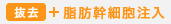 脂肪幹細胞注入