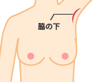 脇の下 抜去部位イメージ