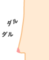 バッグ抜去後そのままの状態