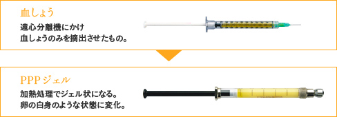血しょうを加熱処理しPPPジェルを作ります