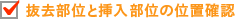 抜去部位と挿入部位の位置確認