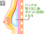 バッグの取り出し後、ポケット（空洞）となる