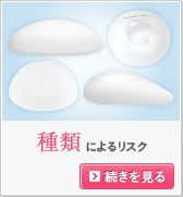 種類によるリスク