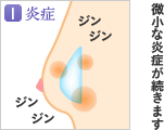 1.炎症／微小な炎症が続きます
