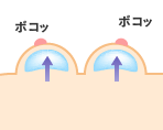 バストの小さい方