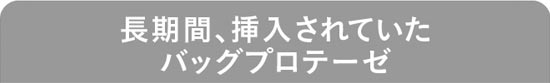 長期間、挿入されていたバッグプロテーゼ