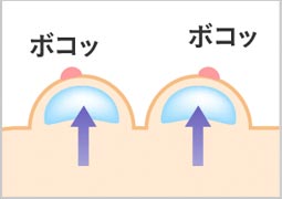 元々バストが小さい人はボコッとして不自然