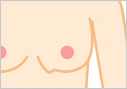 バッグの辺縁が折れ曲がってバストの一部が尖って見える