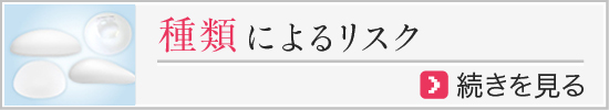 種類によるリスク