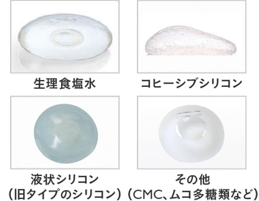 種類