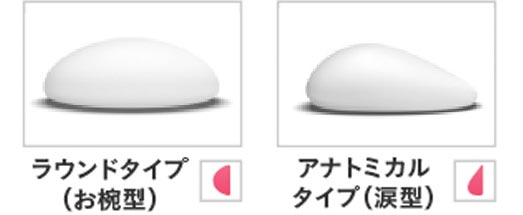 バッグの形状