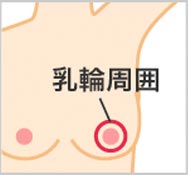 乳頭周囲