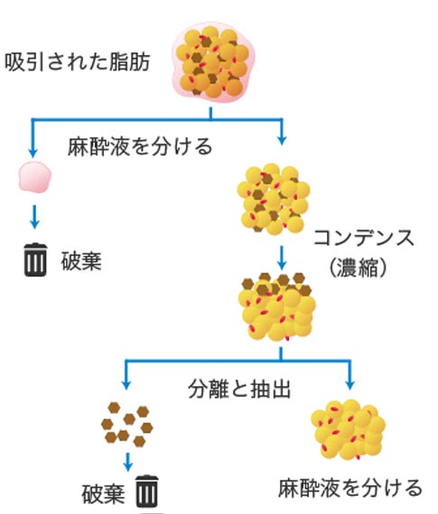 コンデンスリッチ豊胸