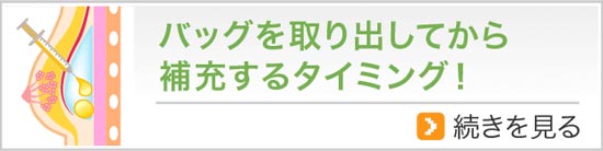バッグを取り出してから補充するタイミング！
