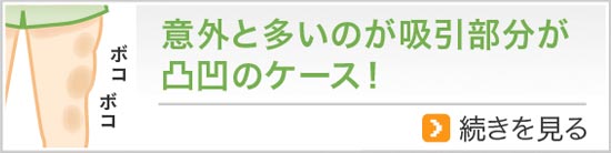 意外と多いのが吸引部分が凸凹のケース！
