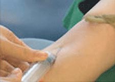 採血