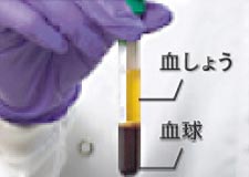 遠血しょうのみを抽出心分離機